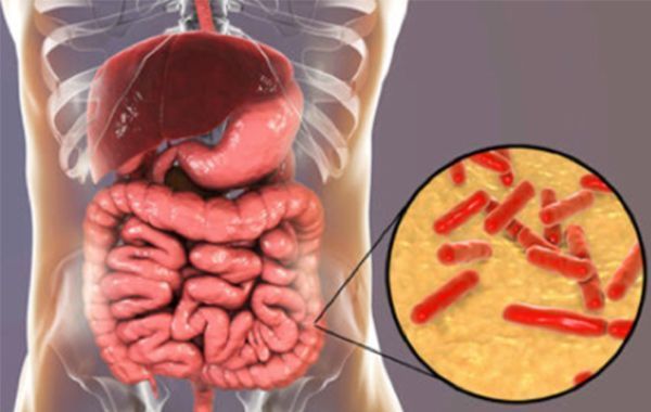 Sludge digestion Sludge digestion
